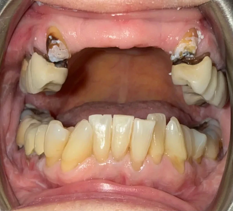 Before photo of a patient's smile