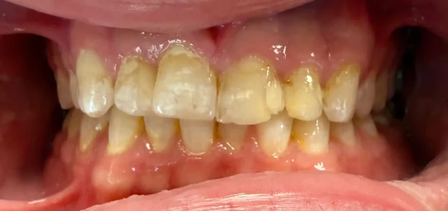 Before photo of a patient's smile